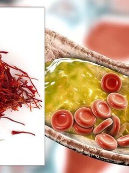 Phát hiện mới: Loại thảo dược này làm giảm 50% mức cholesterol chỉ sau 3 tuần