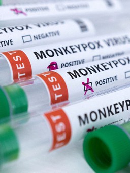 Tìm thấy ADN virus gây bệnh đậu mùa khỉ trong tinh dịch nam giới
