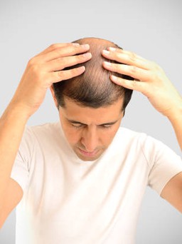 Rụng tóc sớm ở nam có điều trị được không?