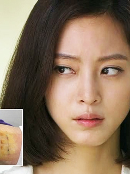 Mỹ nhân Han Ye Seul bị lở loét sau phẫu thuật