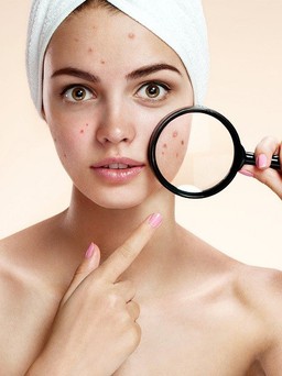 Hướng dẫn các bước skincare cho da mụn hiệu quả ngay tại nhà