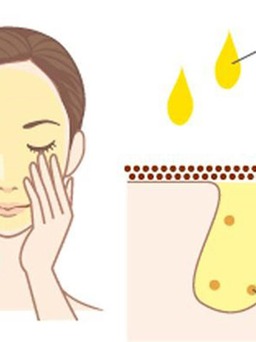 Tips tẩy trang đúng chuẩn cho làn da hết mụn và ngăn ngừa tái phát