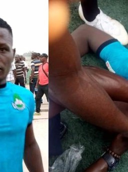 Bi kịch cầu thủ qua đời do va chạm trên sân: Nigeria đình chỉ giải hàng đầu
