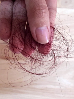 Mẹo vặt: Cách đơn giản giúp giảm rụng tóc cho chị em