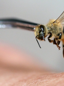Bị hơn 20.000 con ong 'sát thủ' đốt, thanh niên Mỹ phải thở máy