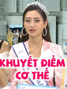 Ai ngờ Hoa hậu, Á hậu cũng có những khuyết điểm cơ thể khiến họ không tự tin