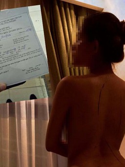 Vụ ‘Người mẫu ảnh nude tố họa sĩ bodypainting cưỡng hiếp’: Công an công bố kết quả giám định pháp y