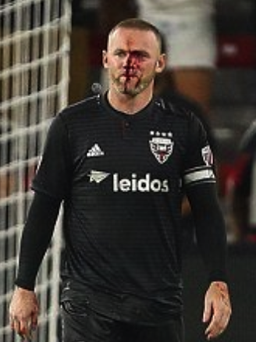 Rụng rời với gương mặt đầy máu vì chấn thương của Rooney