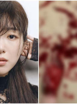 Nữ ca sĩ xinh đẹp Mina đăng ảnh máu me, nghi tự tử khiến fan hoang mang