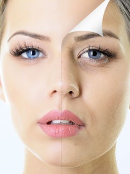 6 điều bạn nên cân nhắc trước khi tiêm Botox
