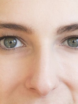 Vì sao mụn đầu đen không ngừng quay trở lại?