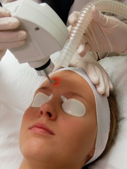 Câu chuyện của laser trong công cuộc làm đẹp