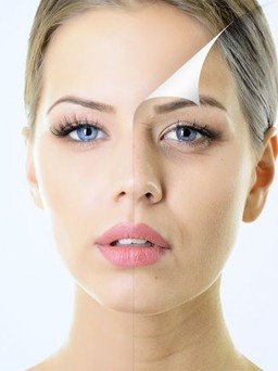 Phẫu thuật căng da mặt