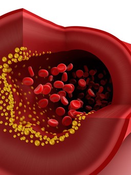 Đúng sai về cholesterol?