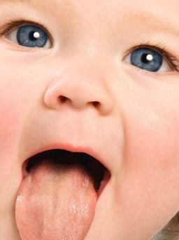 Trẻ sinh thường dễ bị nấm lưỡi!