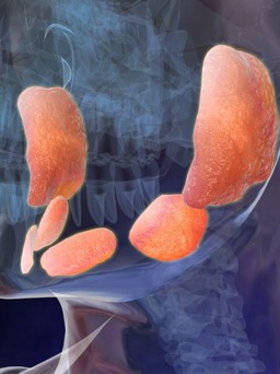 Quai bị là vô sinh?