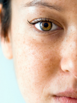 Đừng bỏ qua 5 dấu hiệu của căn bệnh ung thư da