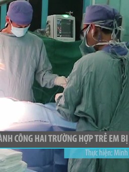 Điều trị thành công hai trường hợp trẻ em bị dính khớp sọ
