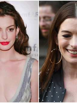 'Công chúa' Anne Hathaway gây sốc với gương mặt già nua, xuống sắc