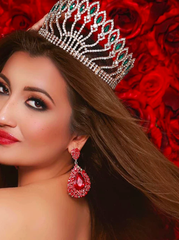 Shree Saini: Cô gái biến dạng mặt vì bỏng trở thành á hậu Miss World