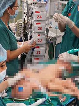 Gần 100 y, bác sĩ đang phẫu thuật tách cặp song sinh dính nhau vùng bụng chậu