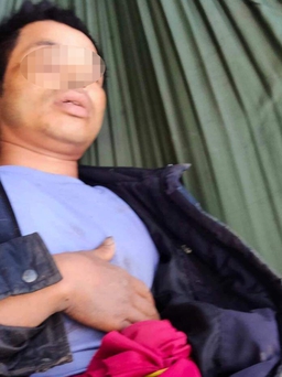 Quảng Trị: Một người ở xã Húc bị trâu húc thủng bụng