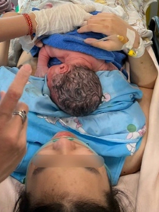 Hy hữu: Cứu thai nhi sa chân khỏi âm hộ người mẹ, giúp mẹ tròn con vuông