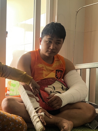 Vụ shipper bị đánh gãy hai tay ở Quảng Ngãi: Chờ kết quả giám định thương tật