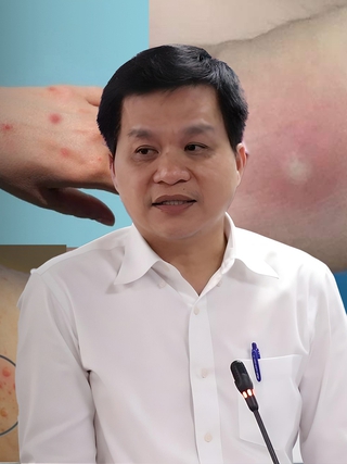 HCDC hướng dẫn cách phòng bệnh đậu mùa khỉ