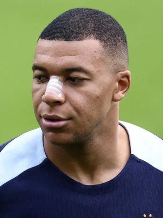 Hình ảnh mới nhất của sao Pháp: ‘Gãy mũi không phải tận thế, Mbappe trở lại rồi đây!’