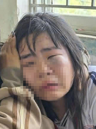 Xử lý nghiêm vụ nữ sinh lớp 7 bị đánh hội đồng trước cổng trường