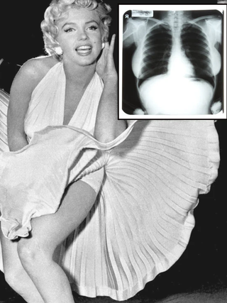 Ảnh X-quang của Marilyn Monroe gây phẫn nộ khi bị đấu giá