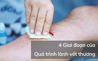 Quá trình lành thương như thế nào, phương pháp giúp phục hồi nhanh ngừa sẹo tối ưu? 
