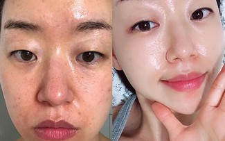 Top 8 kem trắng da chống lão hóa đang được chị em 'săn lùng' trước Tết