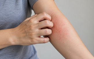 Vì sao người chạy thận nhiều năm bị ngứa da, đau nhức xương khớp?