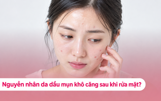 Càng rửa mặt da dầu mụn càng khô căng khó chịu? Hay dùng sai sữa rửa mặt?