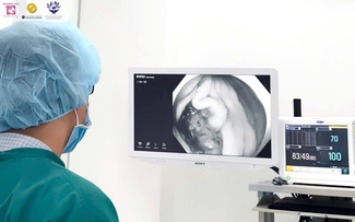37 tuổi, táo bón xen tiêu lỏng nhiều tháng mới phát hiện ung thư đại trực tràng