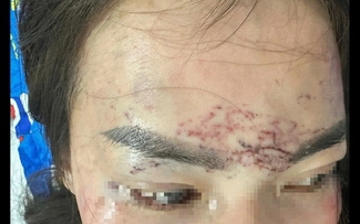 Sắp xét xử vụ chủ cơ sở thẩm mỹ đánh ghen, bắt giữ người trái pháp luật