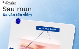 Những lưu ý chăm da sau mụn