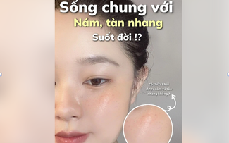 Top 3 serum tranexamic acid mờ nám từ bên trong, da trắng sáng sau 4 tuần