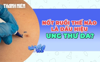 Cảnh báo những nốt ruồi bất thường là dấu hiệu của ung thư da