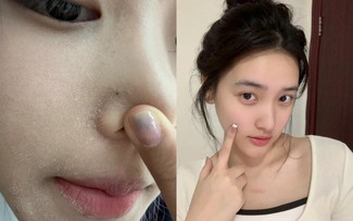 Top 5 serum cấp ẩm đang cháy hàng vì giúp da căng bóng như dùng filter