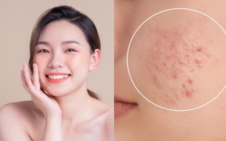 Hết tình trạng bí da mùa hè: Sản phẩm phục hồi này đang gây sốt khắp TikTok