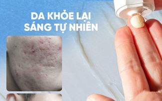 Review chi tiết kem Scar Esthetique làm mờ sẹo rỗ do mụn có tốt không?