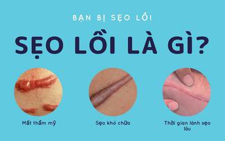 Sẹo lồi bao lâu thì hết? Chuyên gia da liễu trả lời khiến ai cũng bất ngờ