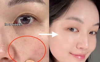 +3 kem retinol khiến chị em giật mình vì da căng bóng glowy, muốn già cũng khó