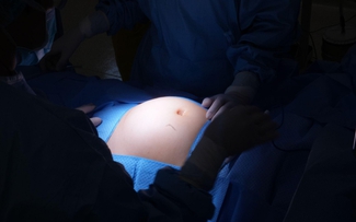 Ngỡ béo bụng, người phụ nữ 30 tuổi phát hiện 28 nhân xơ tử cung