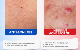 Gel chấm mụn Trioderma hiệu quả với loại mụn nào mà giới skincare đua nhau tìm mua?