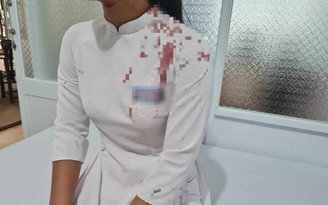 Đắk Lắk: Nữ sinh lớp 10 dùng guốc đánh bạn chảy máu trong giờ ra chơi