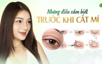 Những thông tin cần biết về phương pháp cắt mí